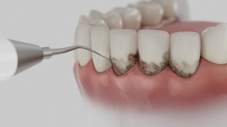 Trusted Dental Implants service in Hampden-Sydney, VA - Dentist Open Now